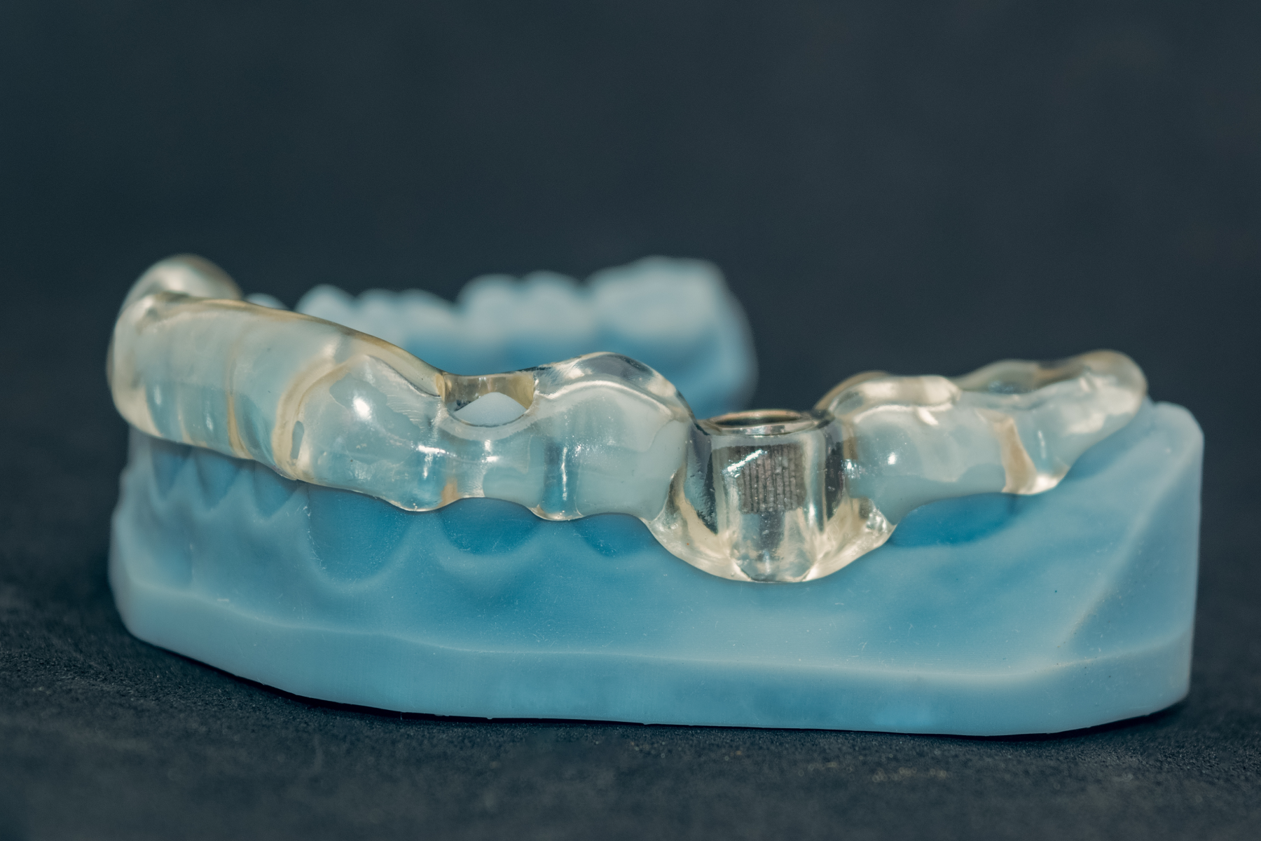 chirurgie guidee Nos technologies Mediweb - Template 5